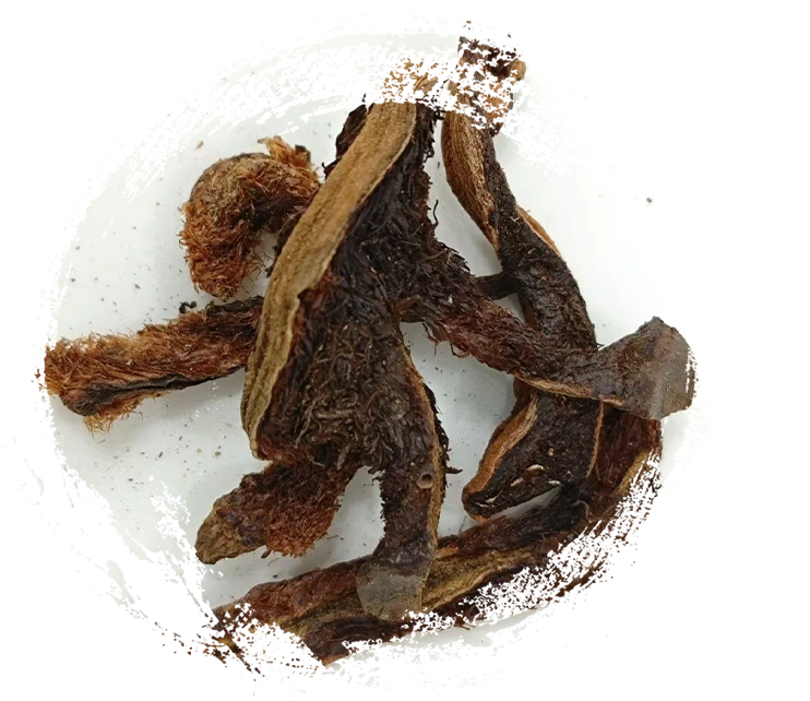 إصلاح شظية العظام